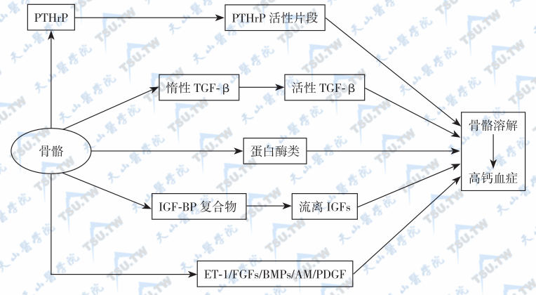  前列腺癌成骨性骨转移伴高钙血症的发病机制