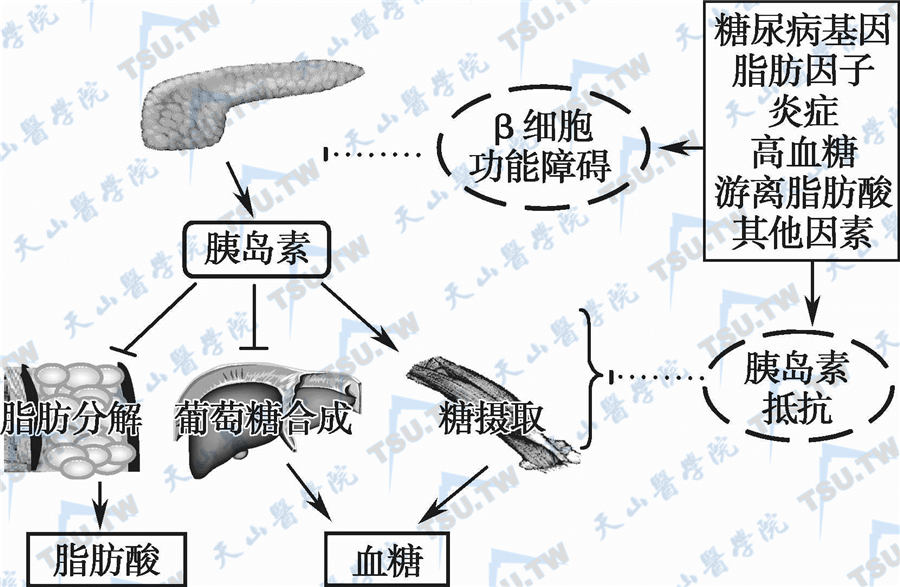  胰岛素抵抗在2型糖尿病发生中的地位