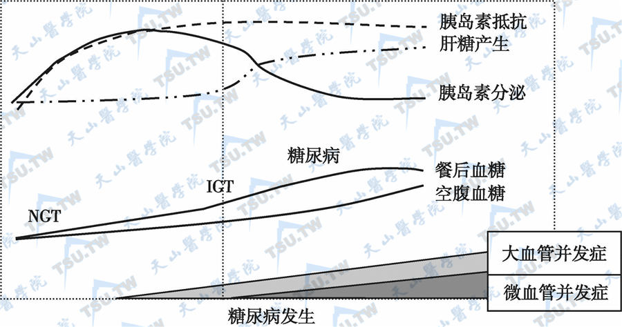 糖尿病临床分期