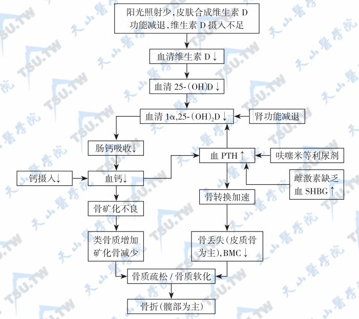  维生素D缺乏和继发性甲旁亢所致的骨病及骨折