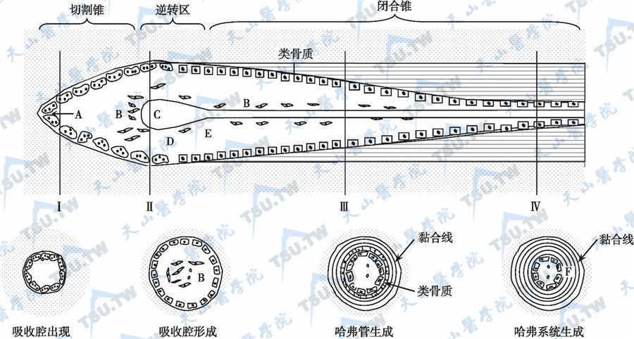  皮质骨中骨重建与皮质骨哈弗系统的建立