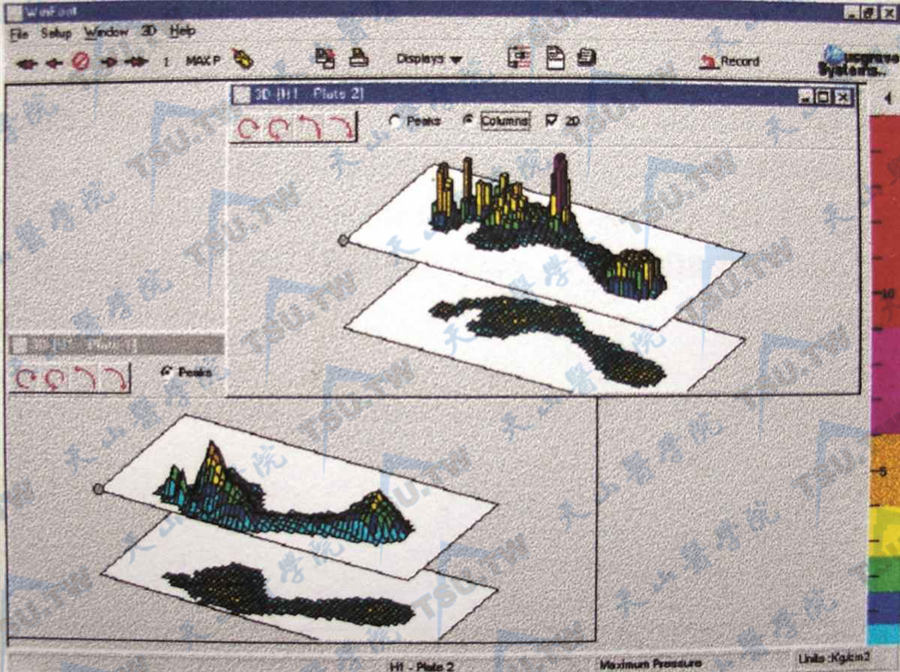  足底压力分析仪（三维成像分析）（峰值或柱状图为受压点）