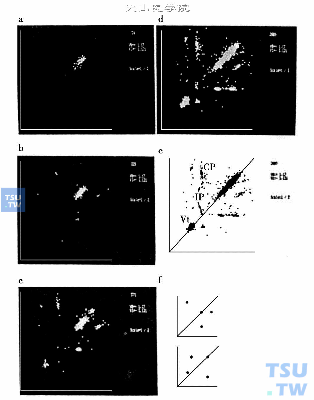  20世纪90年代李方洁用“286”计算机制作的心电散点图