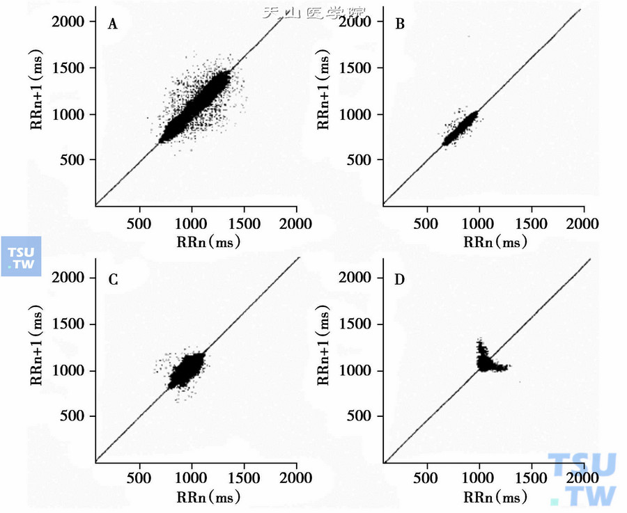  CABG术后不同病人RR间期Poincare图的差异（引自Circulation，2000，101：47-53）