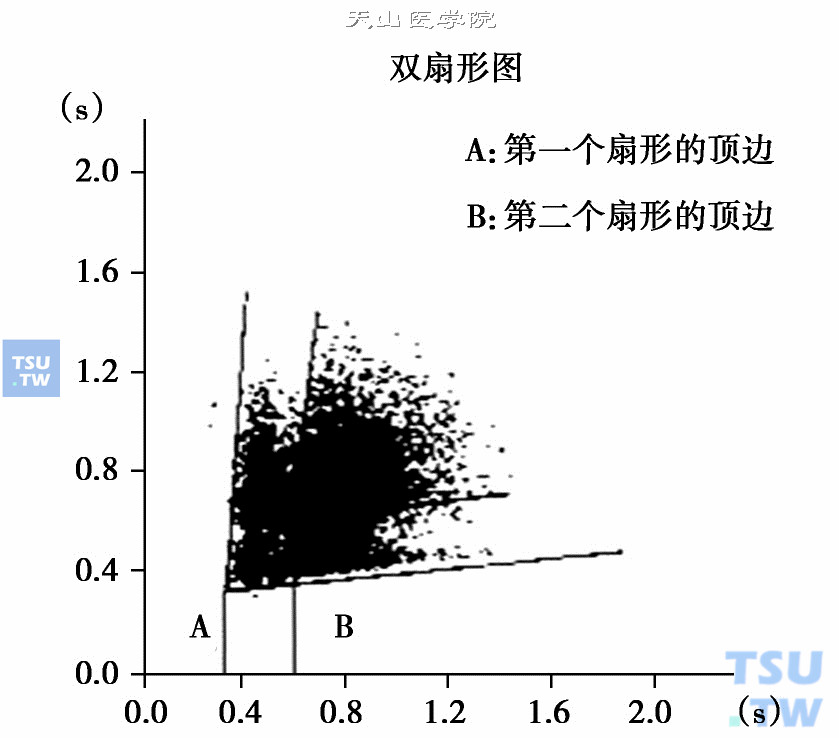  房颤伴房室结双径路的双扇形图形；图中的双扇形存在双底边，靠近X轴的底边被认为是快径的功能不应期，距X轴稍远的底边是慢径功能不应期［引自：J Electrocardiol，1998，31 （3）：227-35］