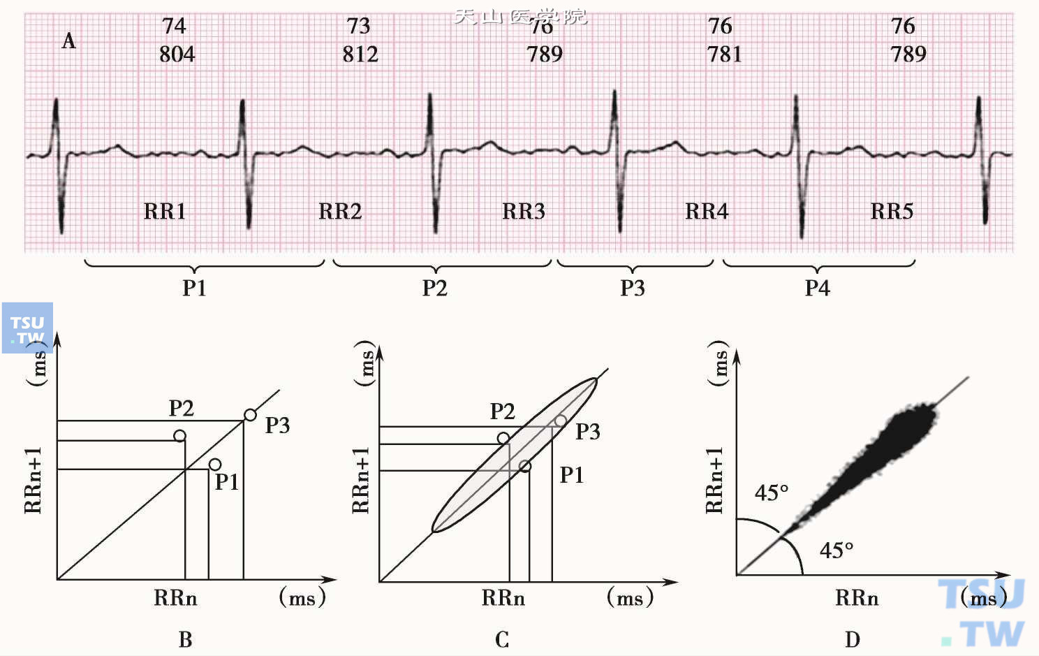 五、心电图各波段的命名及测量-临床心电图教学-医学