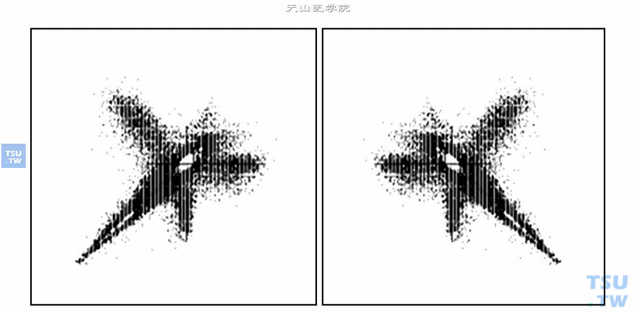  迭代与反迭代的心电散点图；左图是室性并行心律的顺向迭代（X=RRn，Y=RRn+1）图形；右图是室性并行心律的反迭代（X=RRn+1，Y=RRn）图形