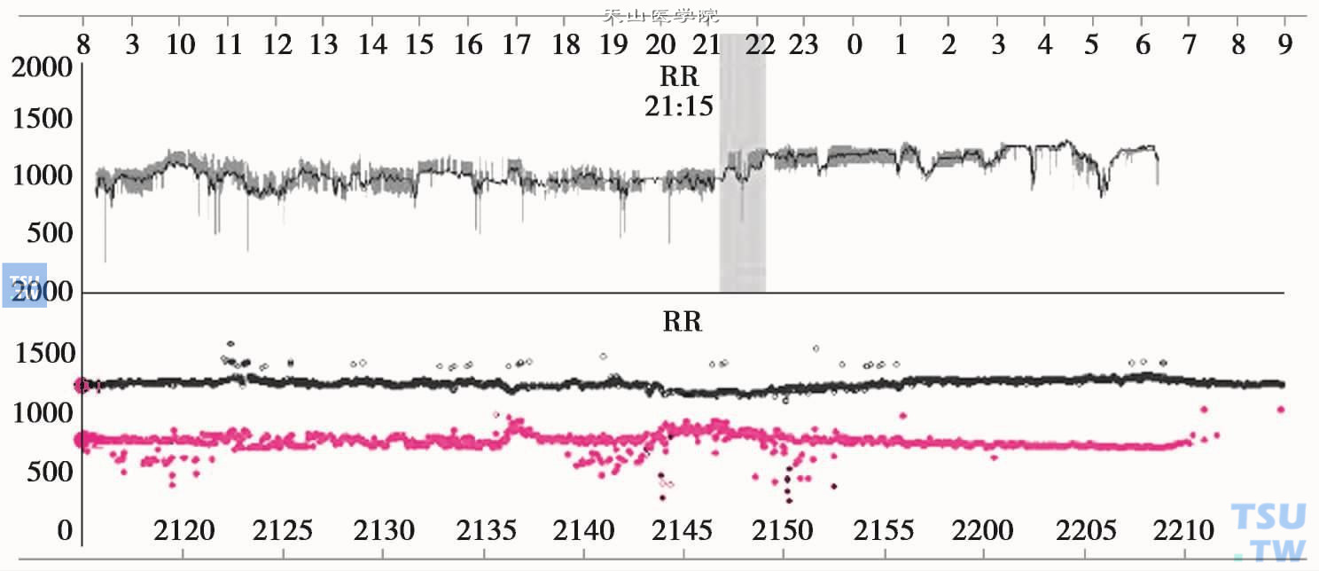  时间RR间期散点图：图中上一幅图是24小时的RR间期变化趋势；下一幅图是将其中1小时的图形延展开的RR间期的趋势图，见到有两种RR间期，纵坐标值较大（RR间期1250ms左右）的一条反映心率较慢，纵坐标值较小（RR间期在750ms左右）的一条反映心率较快