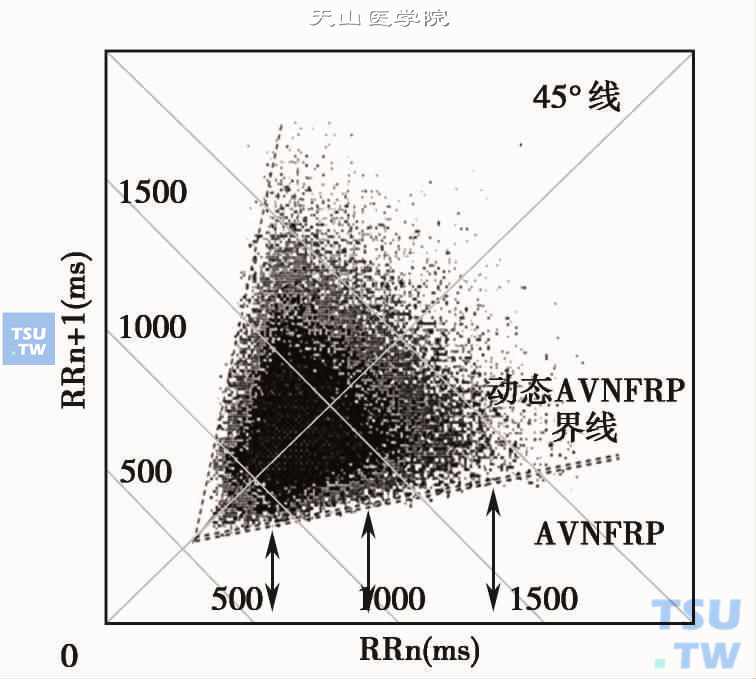 房室结功能不应期的心电散点图特征