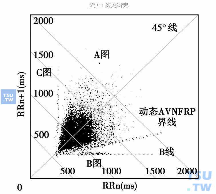  心电散点图中房室分离的图形特征