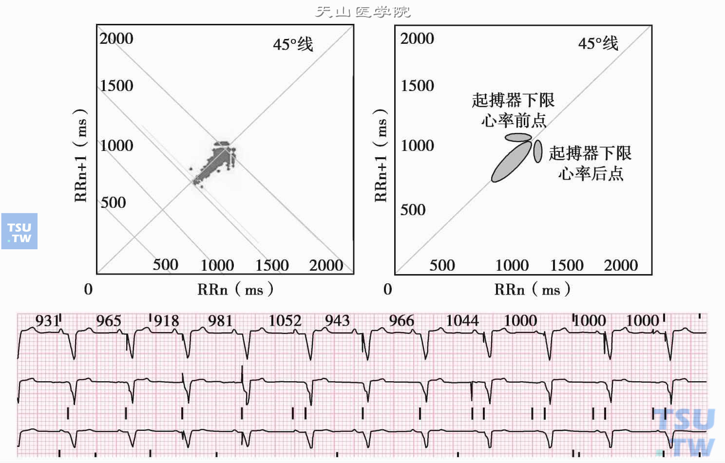 起搏心律的心电散点图