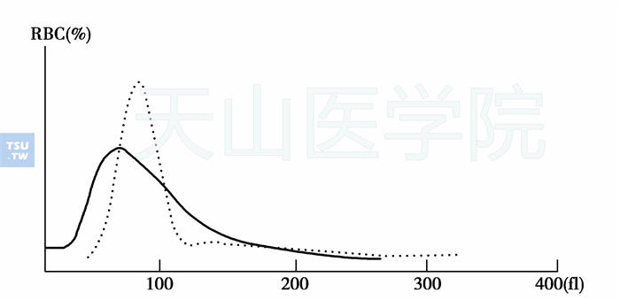 缺铁性贫血