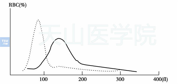 巨幼细胞贫血