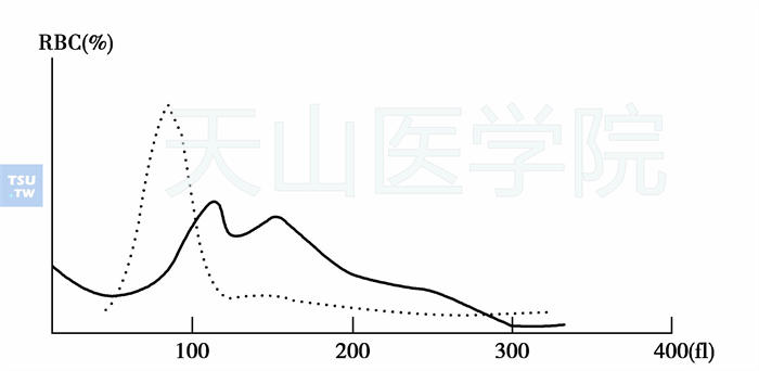 巨幼细胞贫血治疗初期