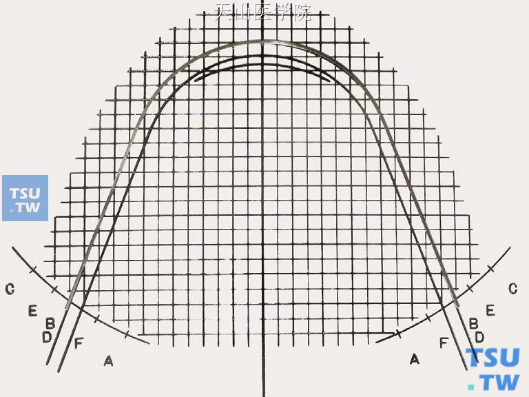 比对弓形图版，弓丝通过B（D）点