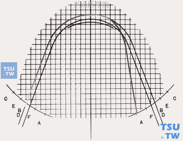 比对弓形图版，弓丝从B（D）点弯制到A点