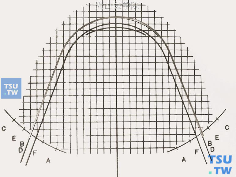 比对弓形图版，弓丝从A点回弯到B （D）点，完成切牙内收弯