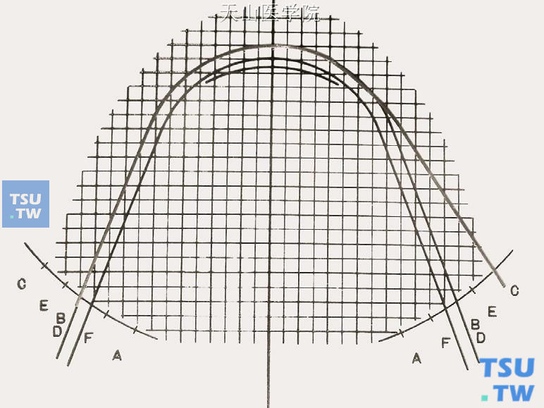 比对弓形图版，弓丝从B（D）点弯制到C点