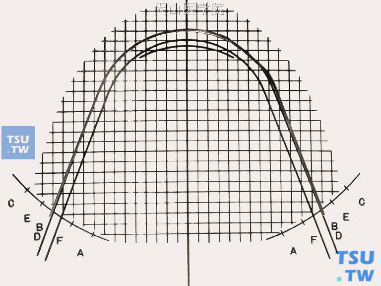 比对弓形图版，弓丝从C点回弯到B （D）点，完成尖牙外展弯