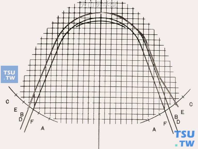 比对弓形图版，弓丝从B（D）点弯制到E点