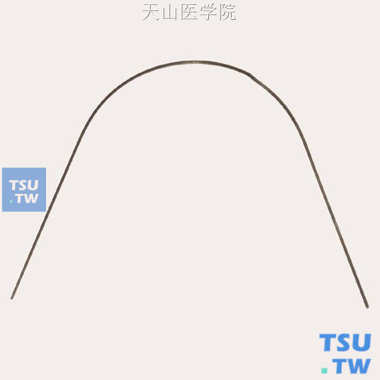 单侧切牙内收弯弯制完成的效果图