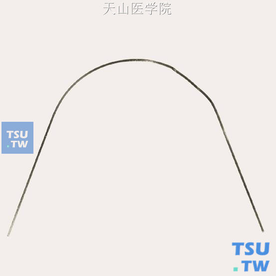 单侧切牙内收弯和尖牙外展弯弯制完成的效果图