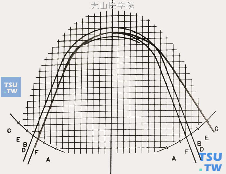 比对弓形图版，弓丝从B（D）点弯制到C点
