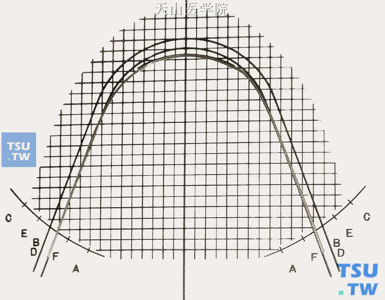 比对弓形图版，弓丝从C点回弯到B （D）点，完成尖牙外展弯