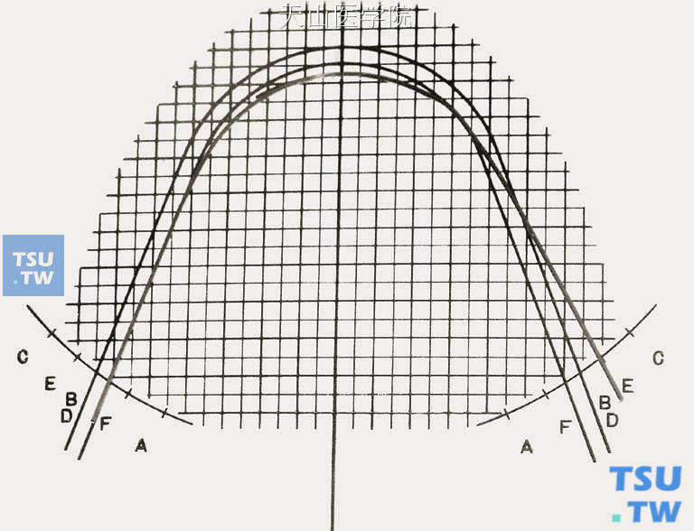 比对弓形图版，弓丝从B（D）点弯制到E点