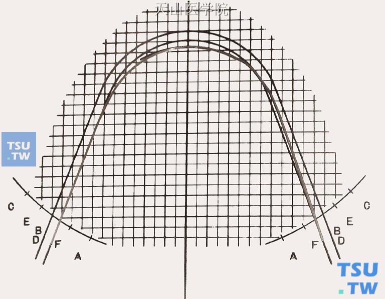 比对弓形图版，弓丝从E点回弯到B（D）