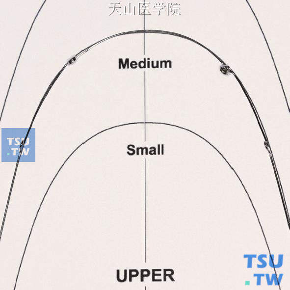 形成上颌标准弓丝形态