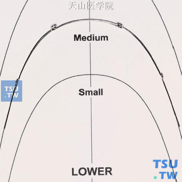 形成下颌标准弓丝形态