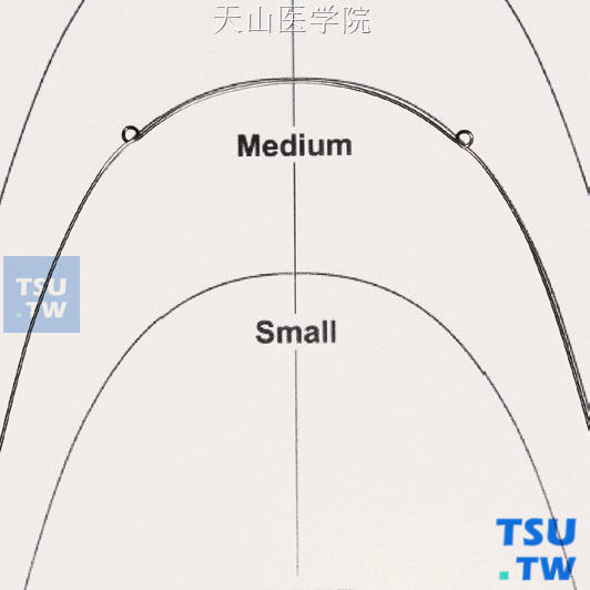 具有上颌标准弓丝形态