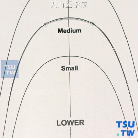 具有下颌标准弓丝形态