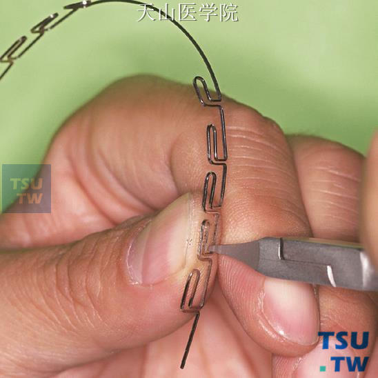 MEAW弓丝的弯制：左手拇指将曲向牙弓外侧压出少许