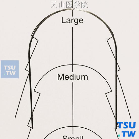 如果前牙区的弓形太大，可用弓丝成形钳（大半圆钳）进行调整