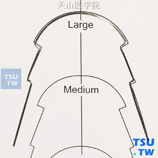 双侧蘑菇形曲在舌侧弓形图版进行比对，注意此时与大号弓形重合