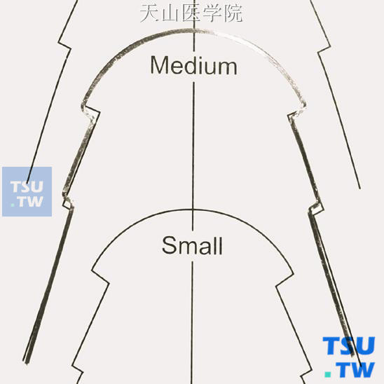 双侧蘑菇形曲在舌侧弓形图版进行比对，已经调整到中号弓形