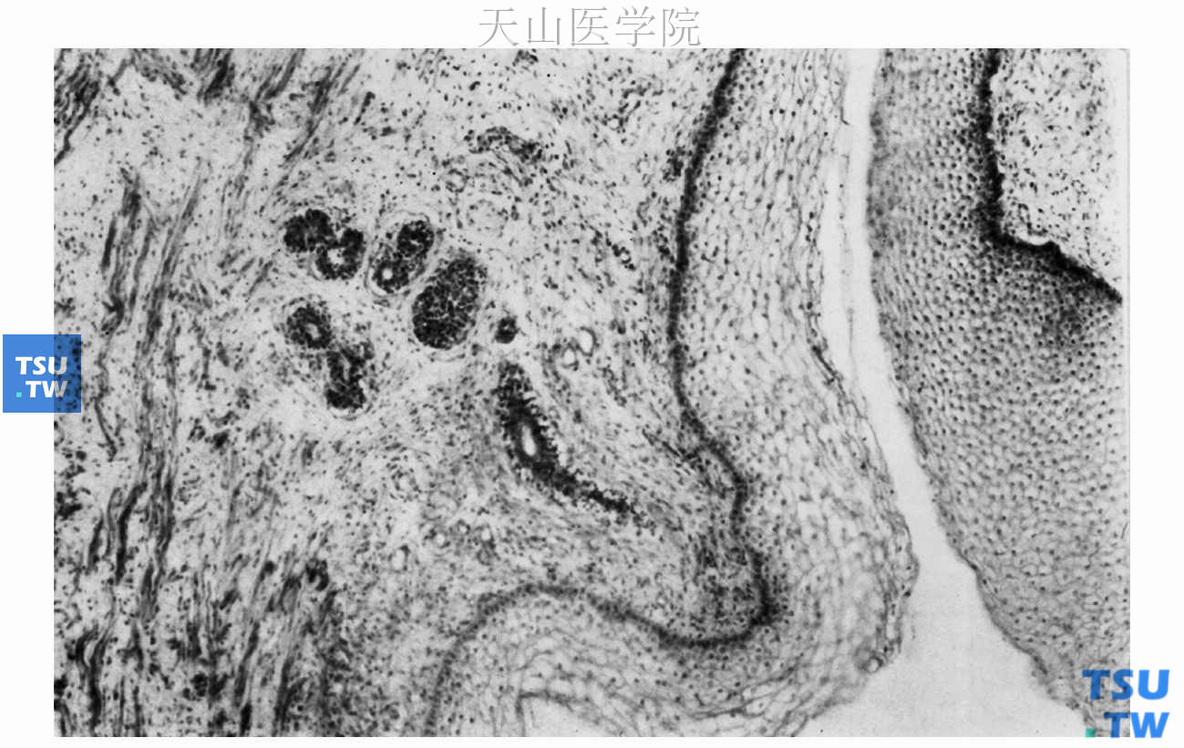 发育中的腮腺位于口腔黏膜的外胚间充质内　×100