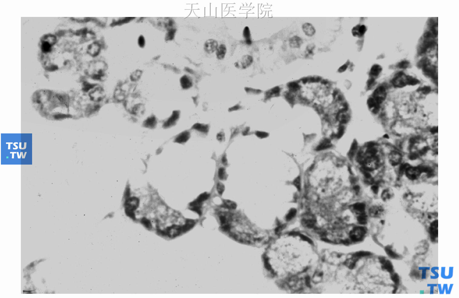 混合性腺泡，由浆液性腺泡和黏液性腺泡构成　×640