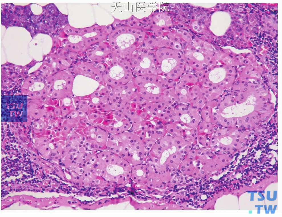 唾液腺组织中的嗜酸细胞团：可见亮细胞和暗细胞