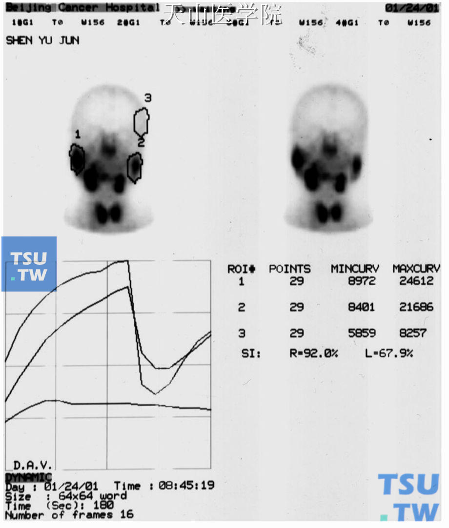 正常腮腺核素显像动态功能曲线