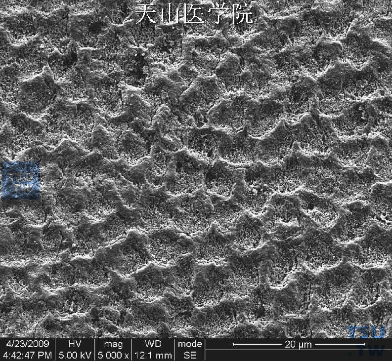 釉柱与柱间质（SEM）