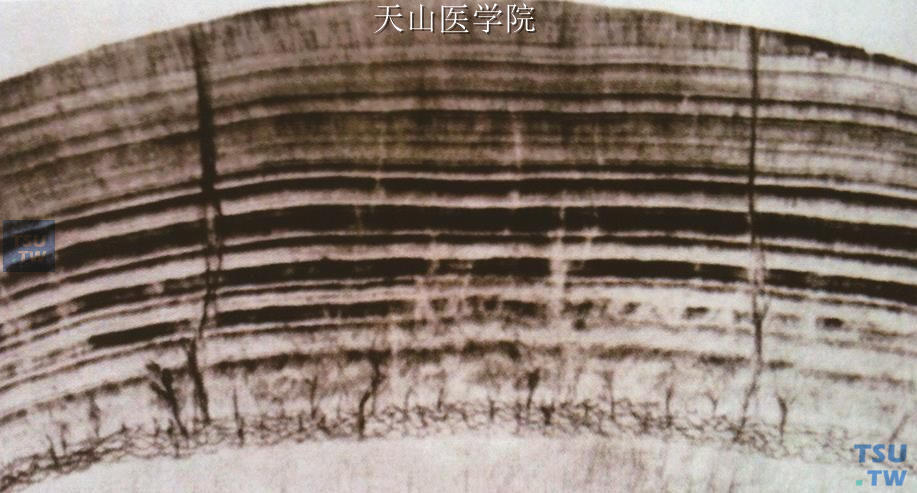 牙釉质内的锐兹线（Retzius’lines）