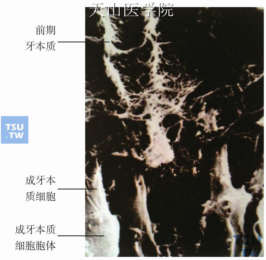 成牙本质细胞突伸入前期牙本质