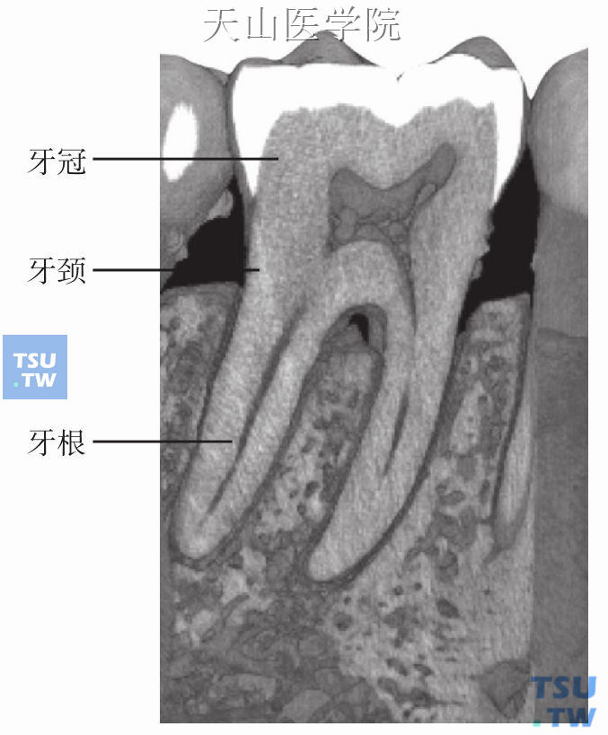 牙体形态