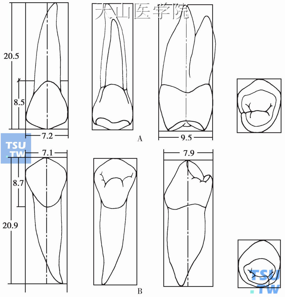 上颌第一磨牙手绘图图片