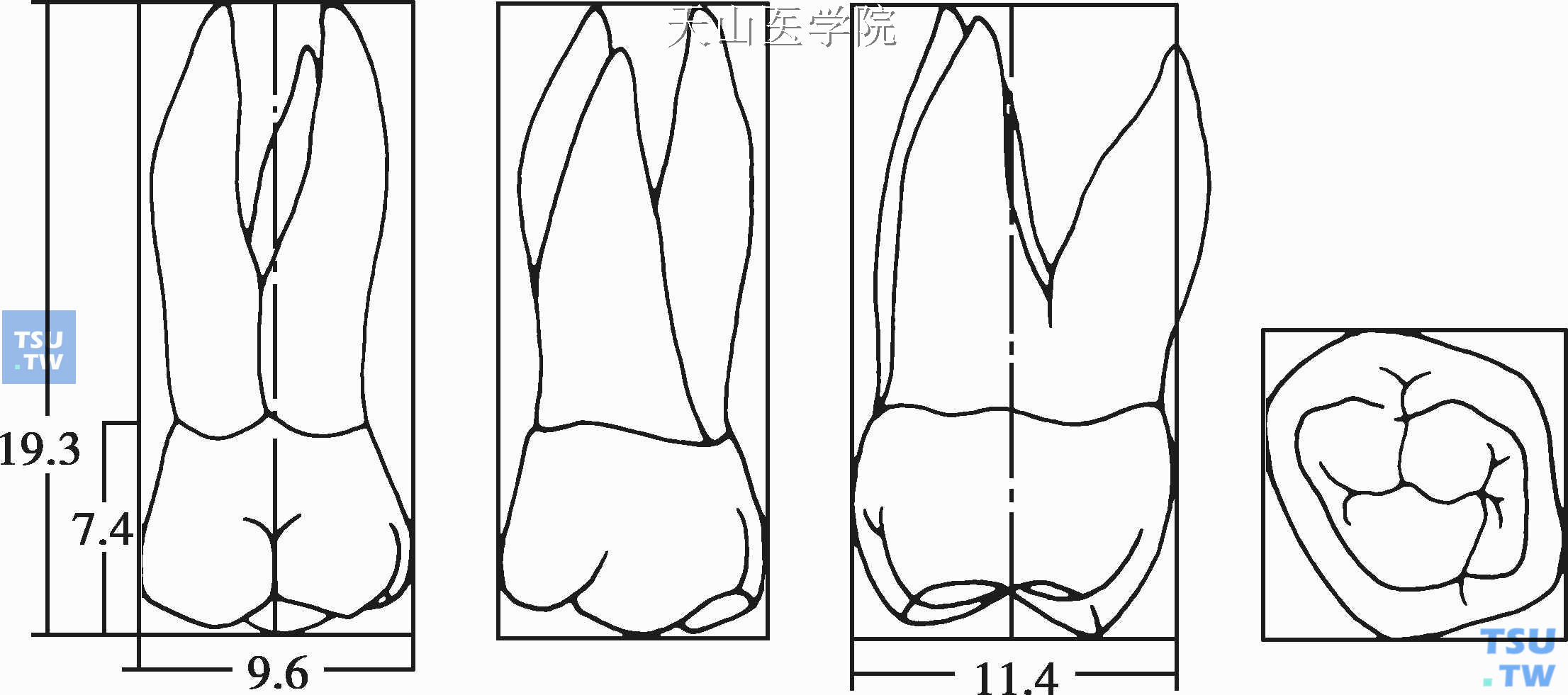 牙髓腔解剖：前牙、磨牙、乳牙髓腔 - 口腔医学 - 天山医学院