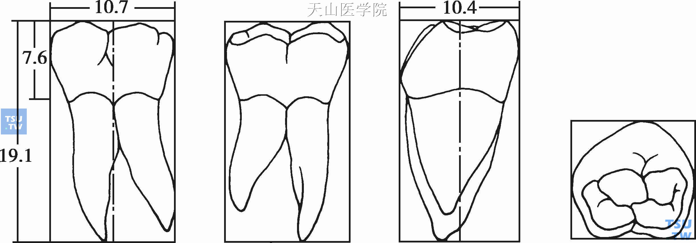 【附图】 牙体解剖：前牙、前磨牙、磨牙 _口腔医学 | 天山医学院