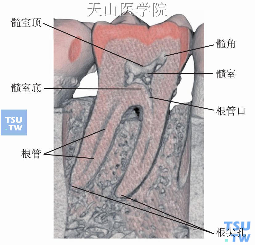 牙髓腔形态